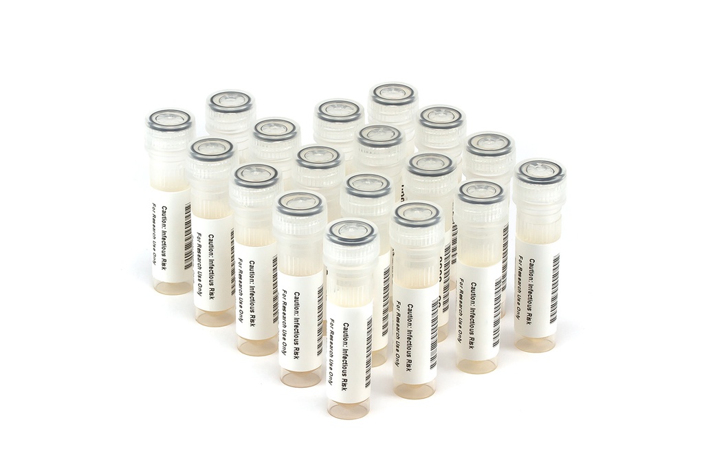 HBV11010 HBV Seroconversion Panel Donor n. 67457 (18x 1 ml)