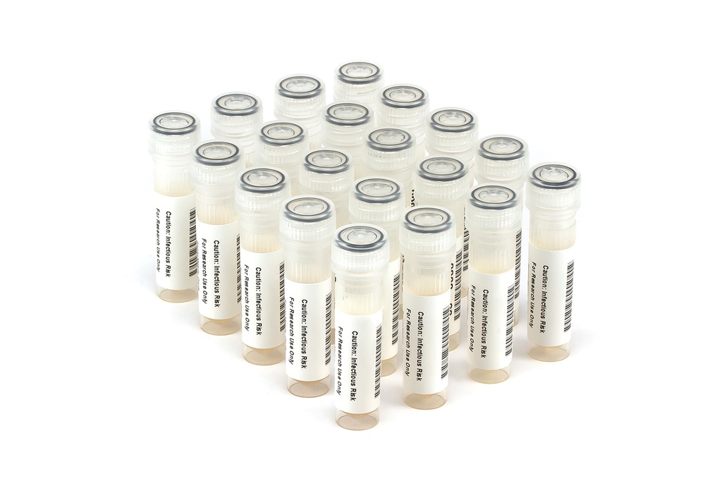 HBV9074 HBV Seroconversion Panel Donor n. 66213 (20x 1 ml)
