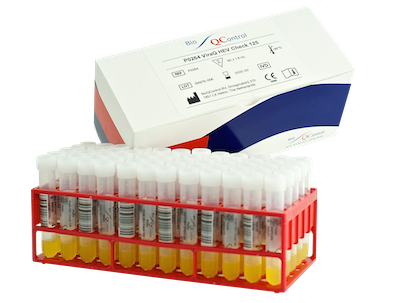 [P0318-01] P0318-01 ViraQ HIV-2 Check 125